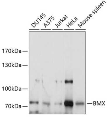 Western Blot: BMX AntibodyAzide and BSA Free [NBP2-92473]